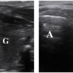 Ultrasound Consent Form