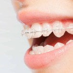 Orthodontic Treatment Consent Form