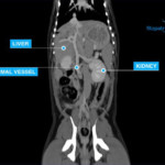 Ct Scan Contrast Consent Form