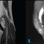 Ct Scan Contrast Consent Form