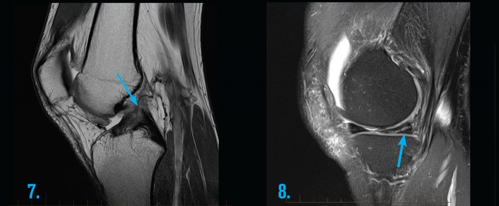 Ct Scan Contrast Consent Form